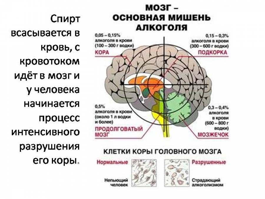 Восстановление коры мозга. Влияние спирта на головной мозг. Как алкоголь влияет на мозг. Алкоголь влияет на головной мозг.